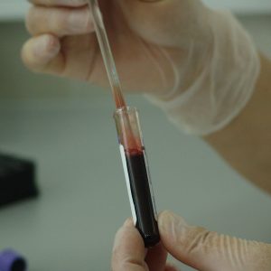 blood, vial, analysis-20745.jpg