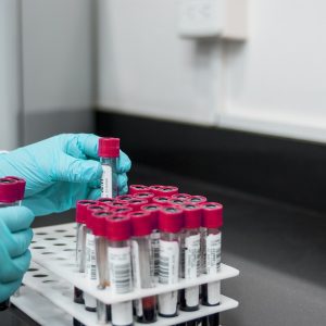 lab, experiment, test-3498584.jpg