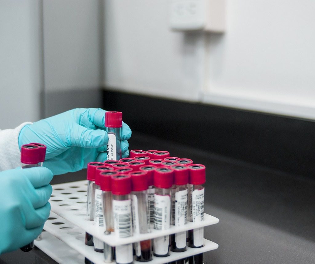 lab, experiment, test-3498584.jpg